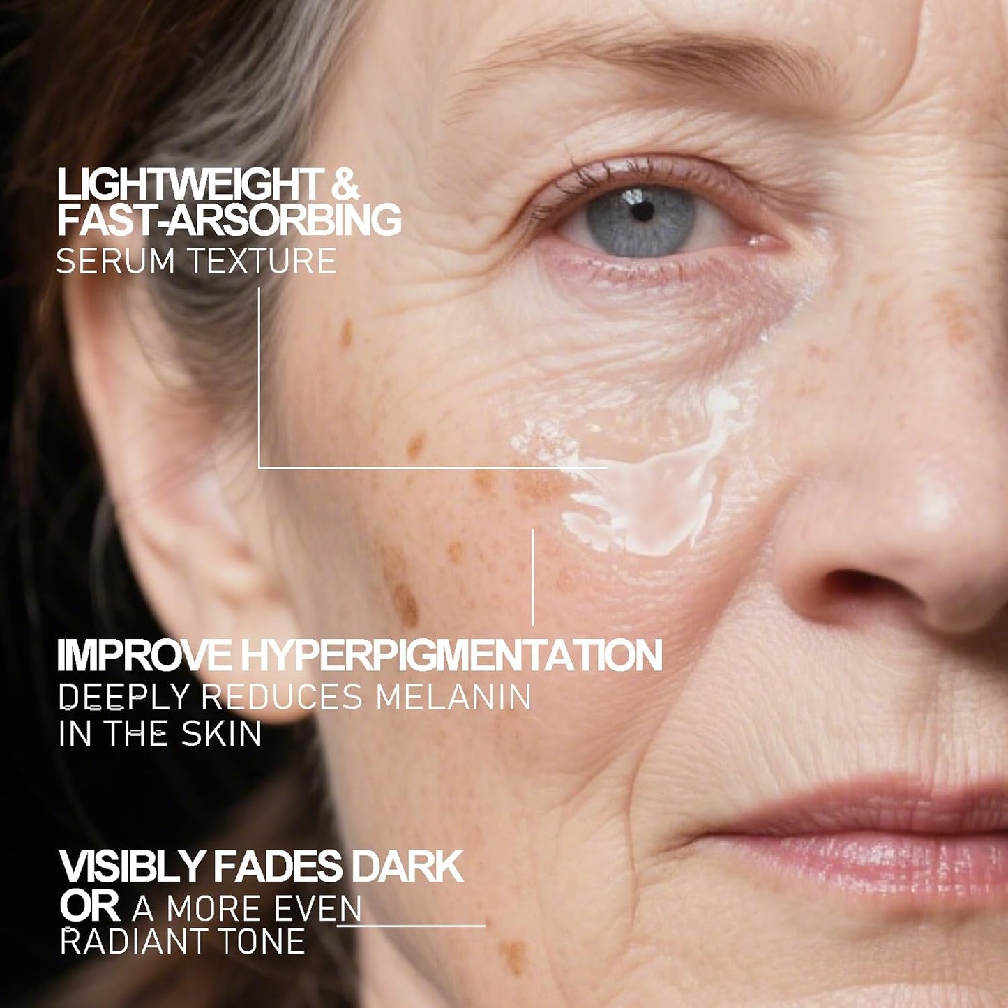 Aobenz dark spot remover serum