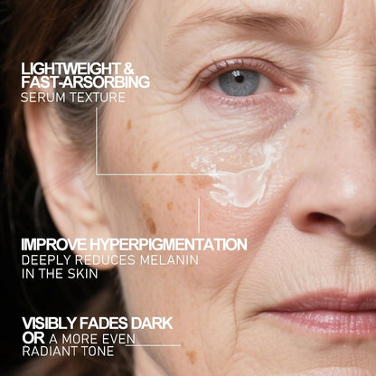 Aobenz dark spot remover serum